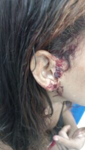 A la cárcel Emil el mototaxista que golpeó a su esposa con un picahielo mientras cargaba a su bebé en brazos