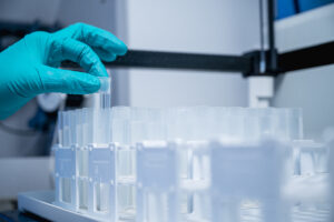 Laboratorio acreditado respalda confianza ciudadana en resultados técnicos precisos y verificables.
